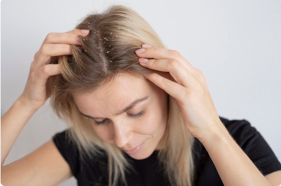 Hair Loss