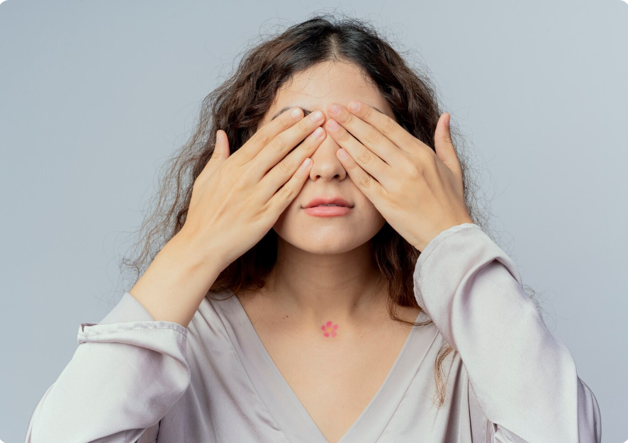 dark circles
