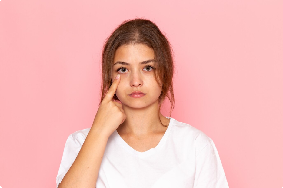 Causes of Dark Circles: Reasons & Solutions